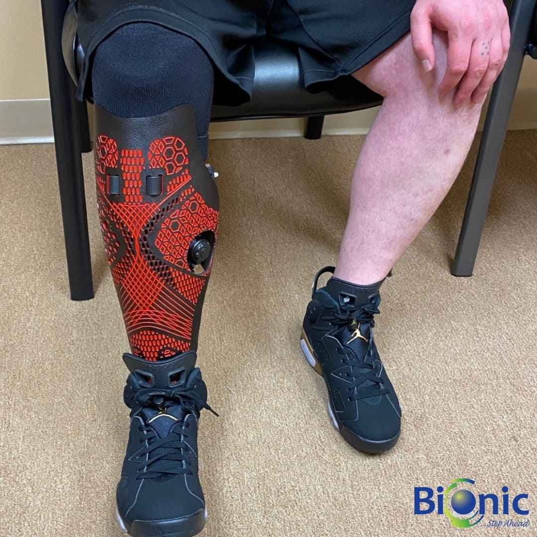 AmputeeOT: How to take off and put on a prosthetic leg (below knee